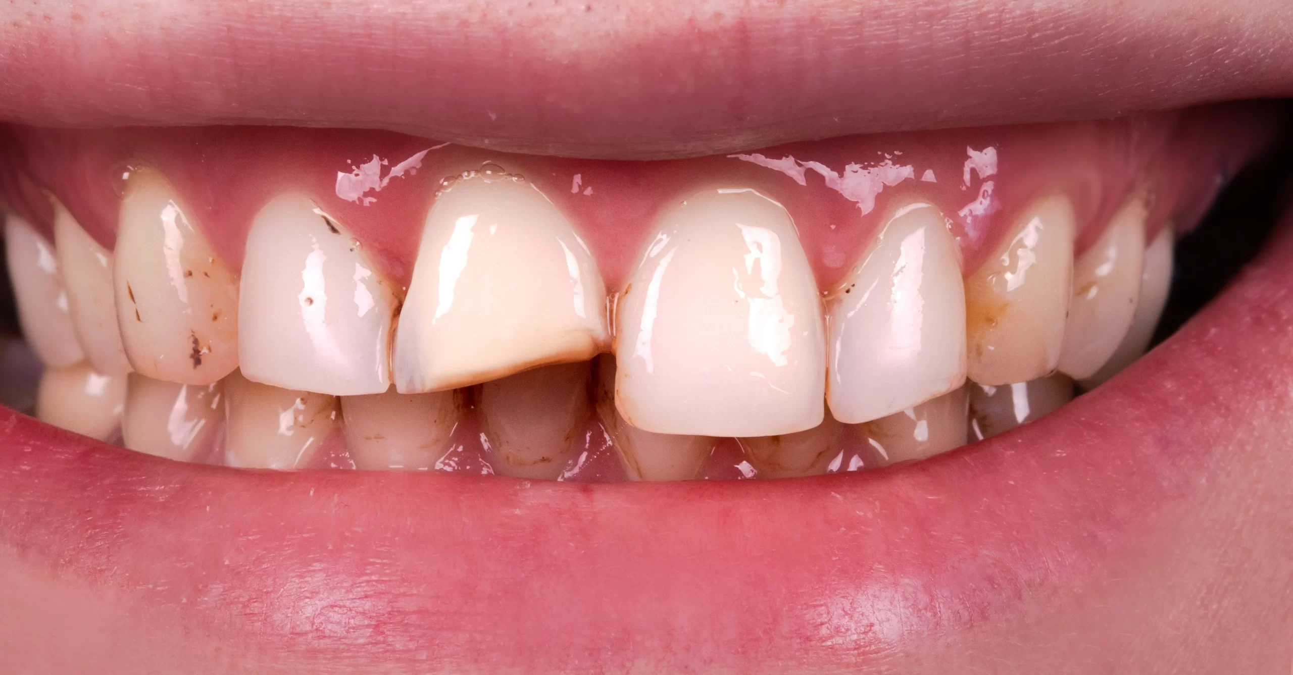 Before cosmetic treatment